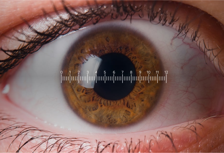 Medición del diametro horizontal del iris