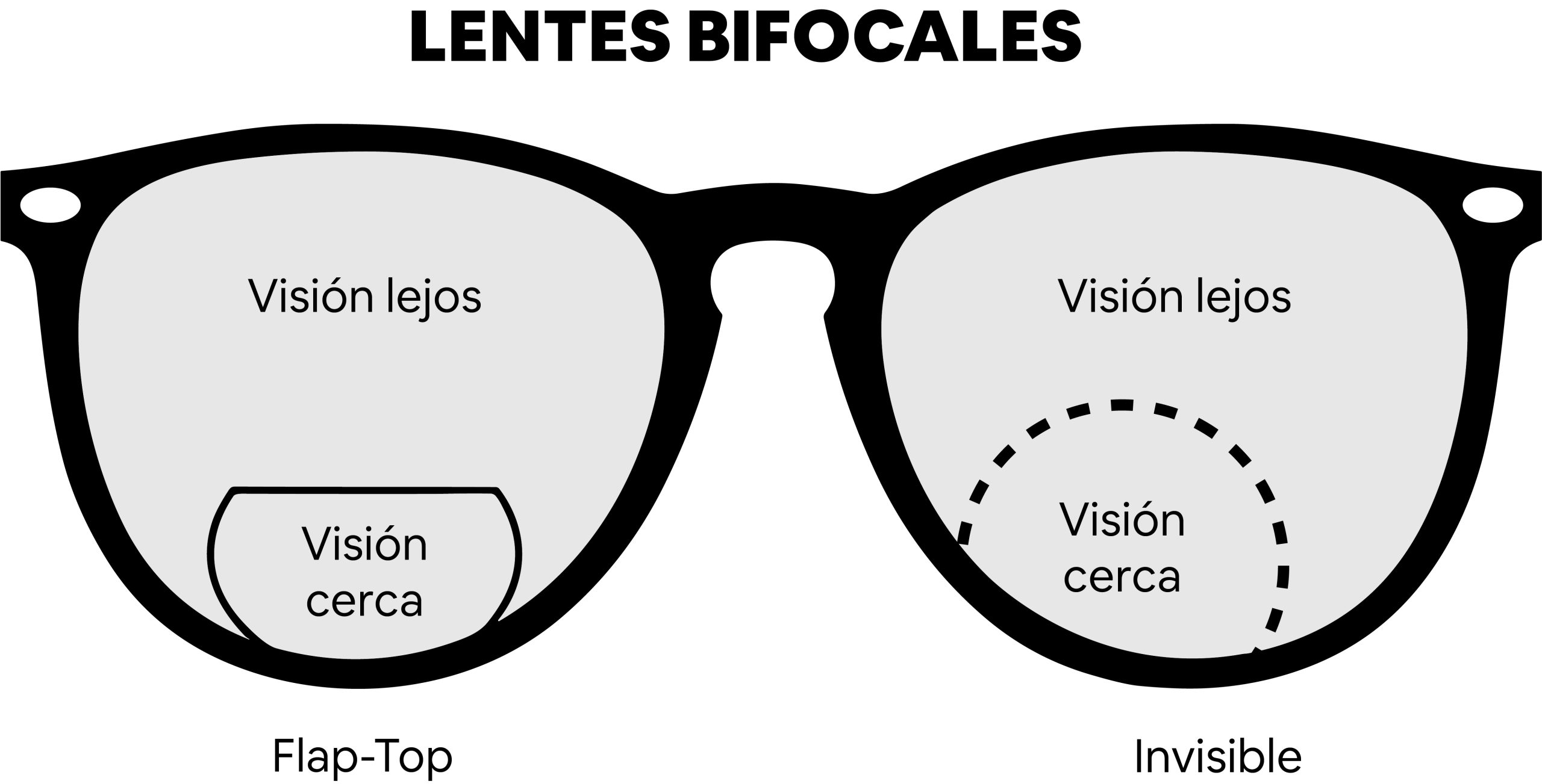 Comparación Bifocal flap top y Bifocal Invisible
